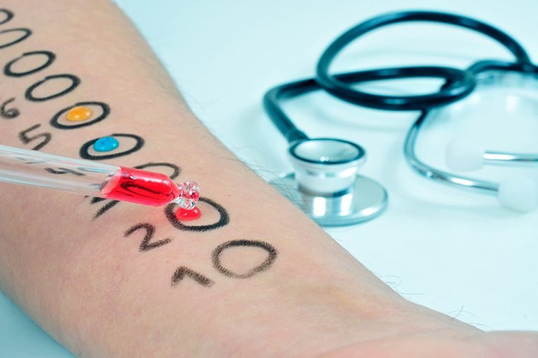 Allergologia