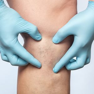 Chirurgia Vascolare